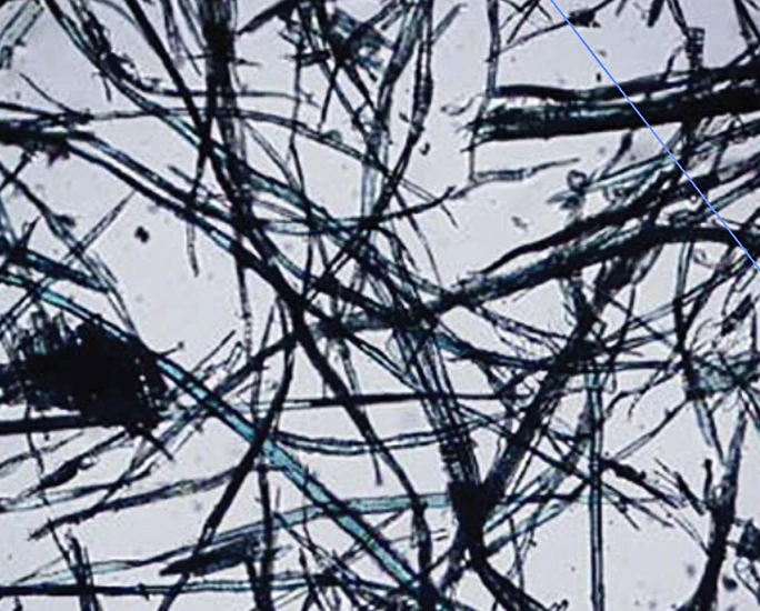 Thin, black, fibrous strands are tangled and crisscrossed against a light background, resembling a microscopic or close-up view of fibers or threads.